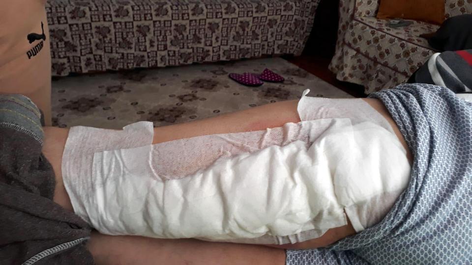Aydın'ın Nazilli ilçesindeki bahçesinde zeytin toplayan çiftçi Ahmet İnan (44), yaban domuzunun saldırısı sonucu sol bacağından yaralandı. İnanın bacağına 60 dikiş atıldı.